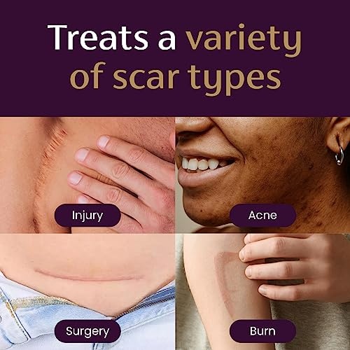 Mederma Advanced Scar Gel, Treats Old and New Scars, Reduces the Appearance of Scars from Acne, Stitches, Burns and More, 0.70oz (20g) - Image 2