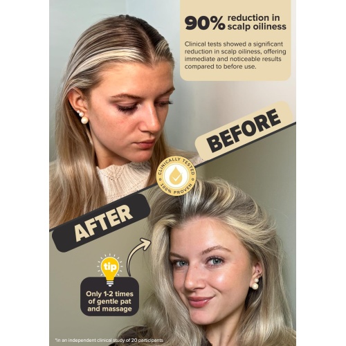 I DEW CARE Dry Shampoo Powder - Tap Secret | With Black Ginseng, Non-aerosol, Benzene-free, Mattifying Root Boost, No White Cast, Travel Size Dry Shampoo for Woman - Image 7